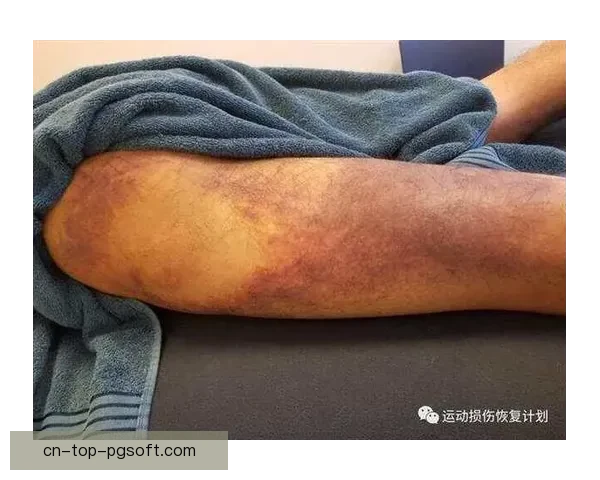加亚频繁遭遇肌肉拉伤困扰如何影响他的职业生涯与恢复计划